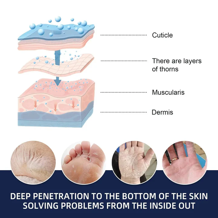 Cracked Foot Heel Treatment Pack of 3