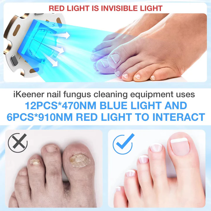 Nail Fungus Laser