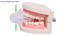 Apnea Tongue Stabilizing Device
