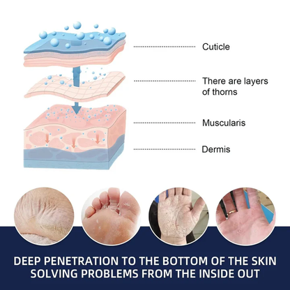 Cracked Foot Heel Treatment Pack of 3