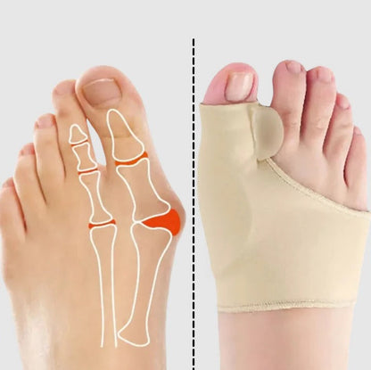 Gel bunion corrector