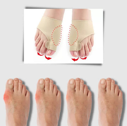 Gel bunion corrector